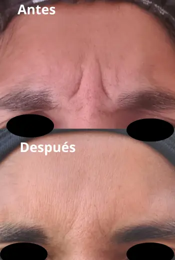 Resultado de estética facial
